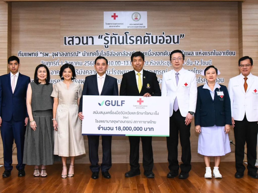 กัลฟ์ มอบ 18 ล้าน หนุน รพ.จุฬาฯ ใช้เทคโนโลยีทำลายเนื้องอกไร้แผล สำเร็จแห่งแรกในอาเซียน